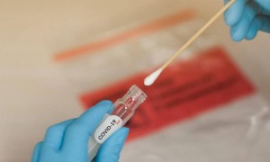 Қазақстанда өткен тәулікте 7778 адамнан коронавирус анықталды