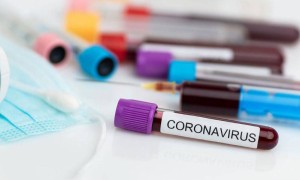 Жапонияда COVID-19 жұқтыру бойынша антирекорд тіркелді