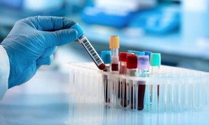 Өткен тәулікте 13 адамнан коронавирус инфекциясы анықталды