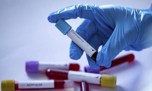 Өткен тәулікте 4826 адамнан коронавирус инфекциясы анықталды