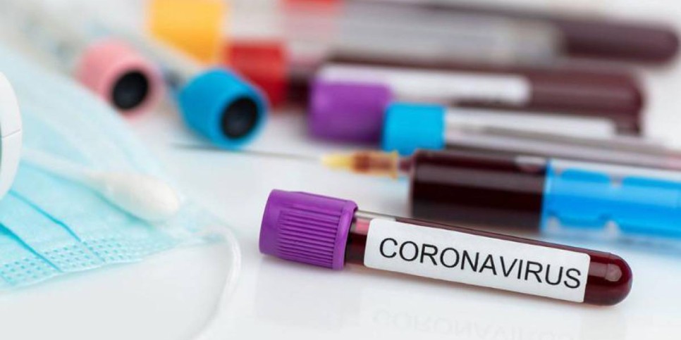 Жапонияда COVID-19 жұқтыру бойынша антирекорд тіркелді